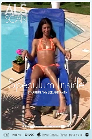 Speculum Inside