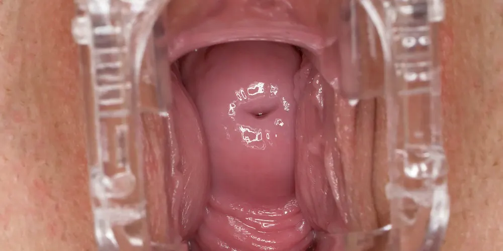 Night Gyno