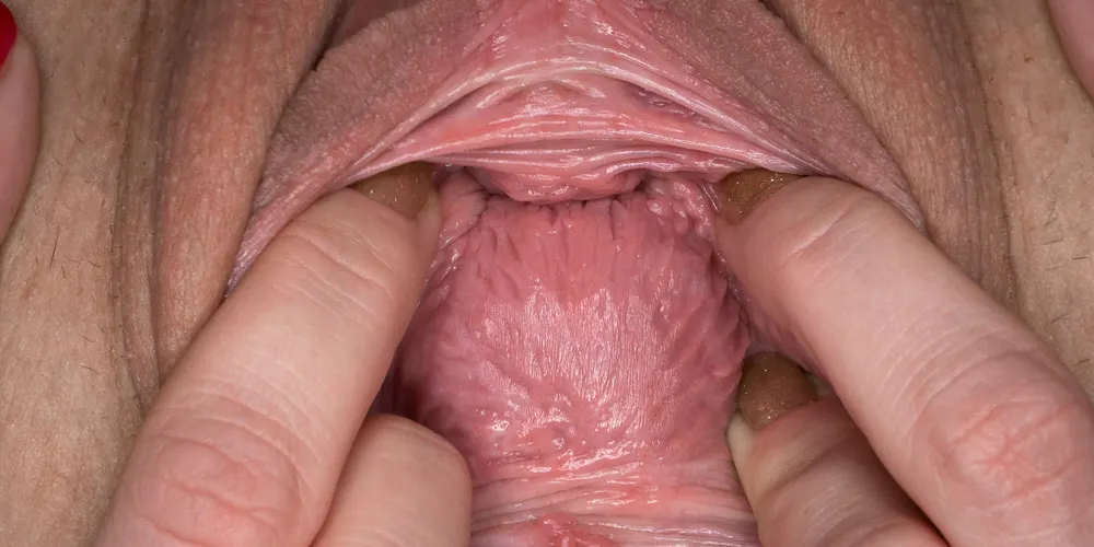 Pussyflex