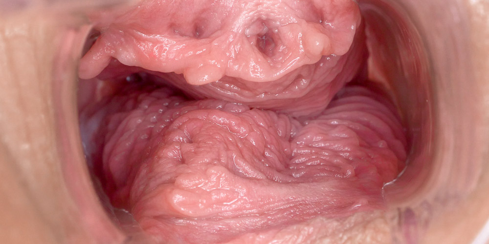 Speculum in Motion