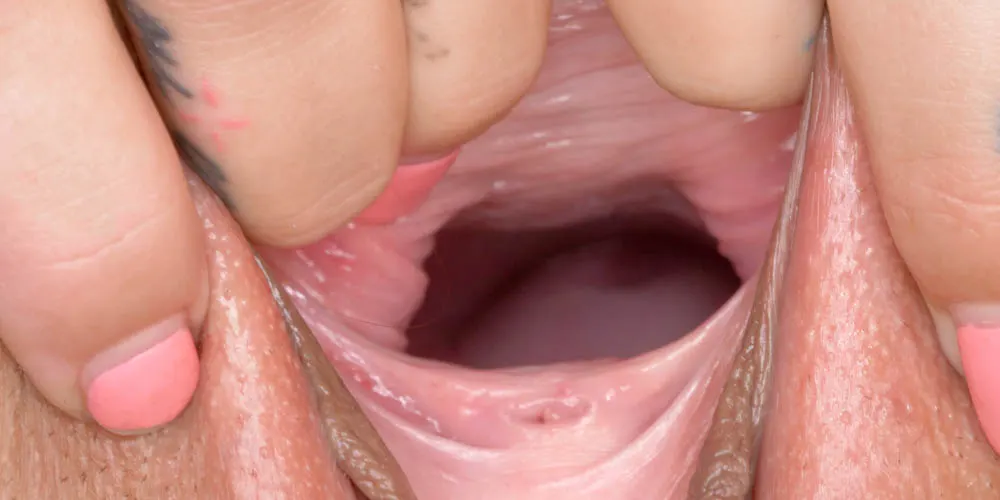 Open Up