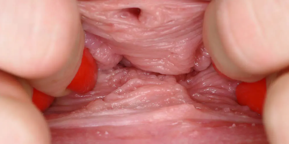 Fingers Inside
