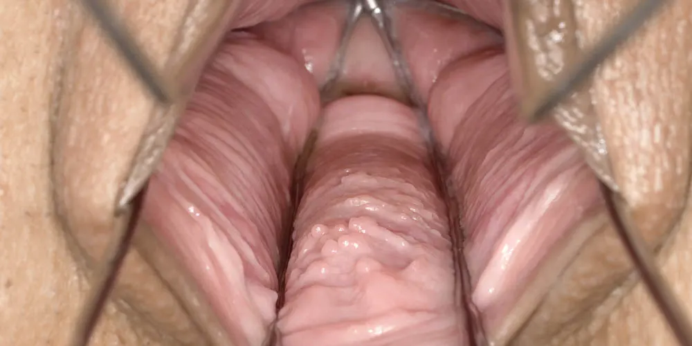Rippled Pussy Meat