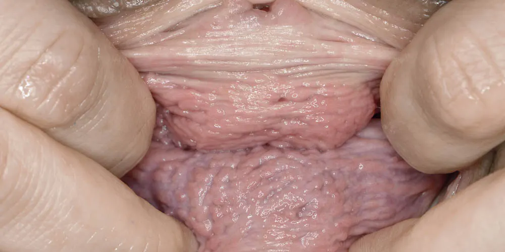 Huge Gapes